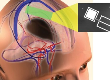 Bước đầu nghiên cứu được phương pháp lấy điện từ... não người