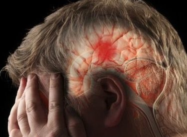 Dành ra 1 phút để cứu sống ít nhất 1 mạng người khỏi tai biến - đột quỵ