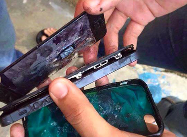 iPhone phát nổ trong túi quần vì nắng nóng, nam thanh niên bị bỏng nặng