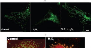 Siêu máy tính góp phần chế tạo thuốc chống lão hóa