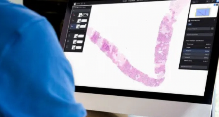 Mô hình AI thị giác giúp chẩn đoán ung thư sớm