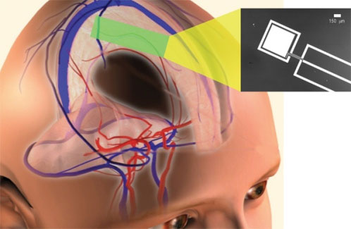 buoc-dau-nghien-cuu-duoc-phuong-phap-lay-dien-tu-nao-nguoi